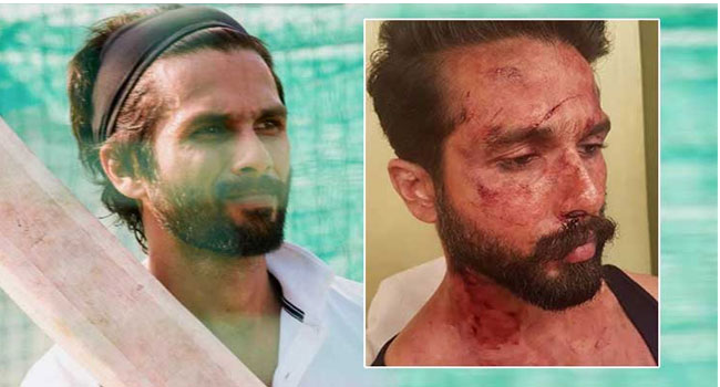 ‘‘25 కుట్లు... ఆ ప్రమాదం తరువాత మళ్లీ నేను మునుపటిలా కనిపిస్తాననుకోలేదు!’’