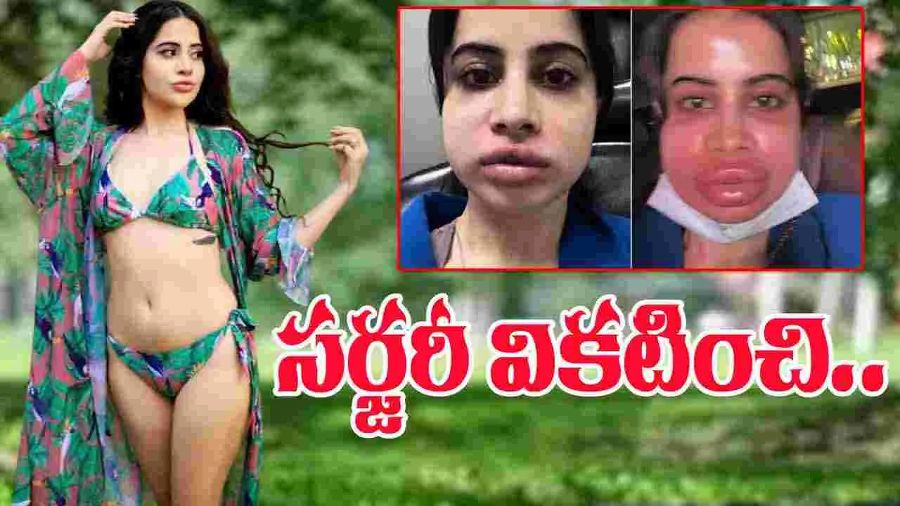Urfi Javed: సర్జరీ వికటించి గుర్తుపట్టలేకుండా మారిన బ్యూటీ