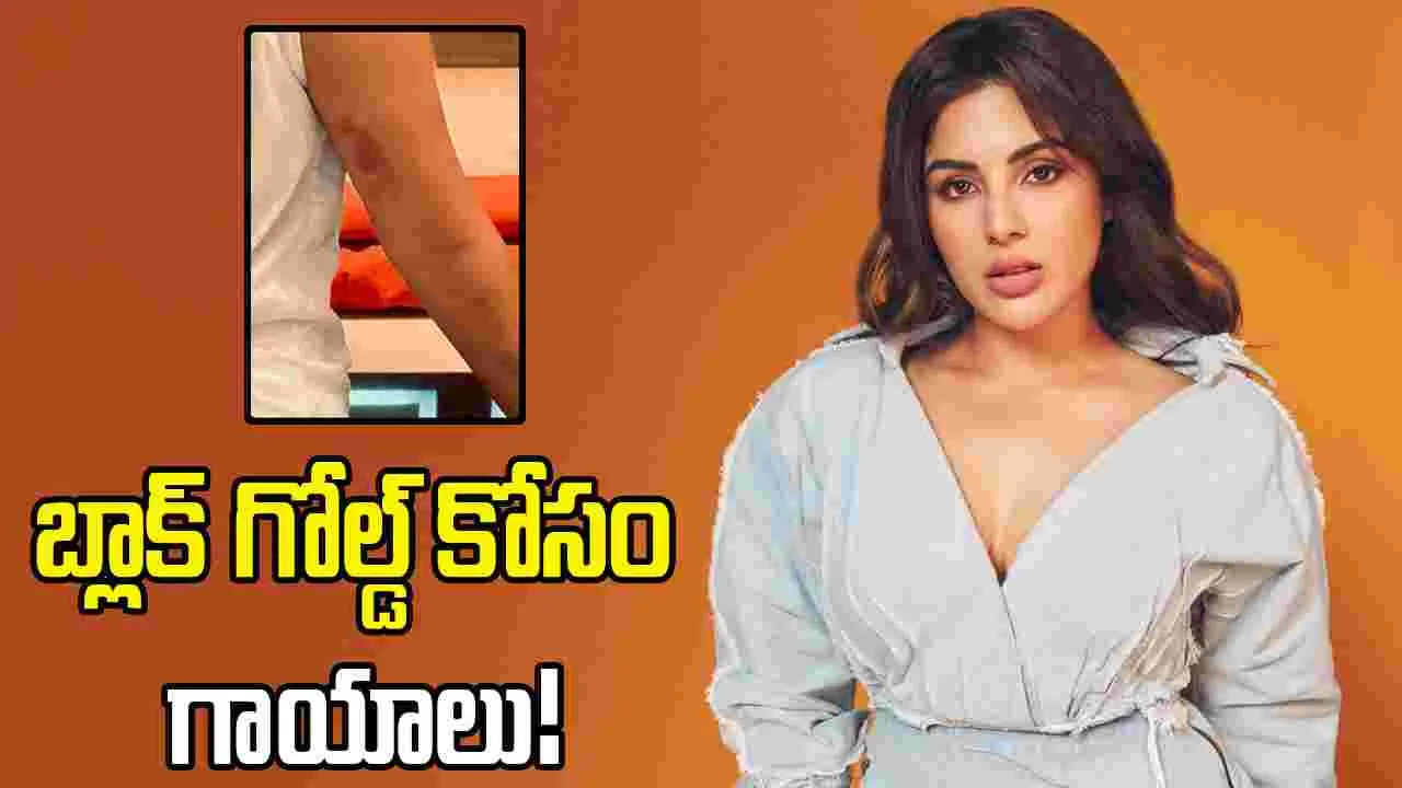 Samyuktha: దెబ్బలను పట్టించుకోకుండా షూటింగ్...